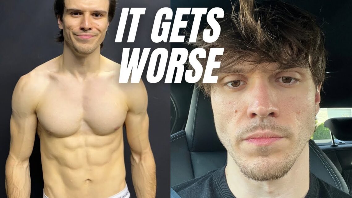 The dark side of losing weight… part 2