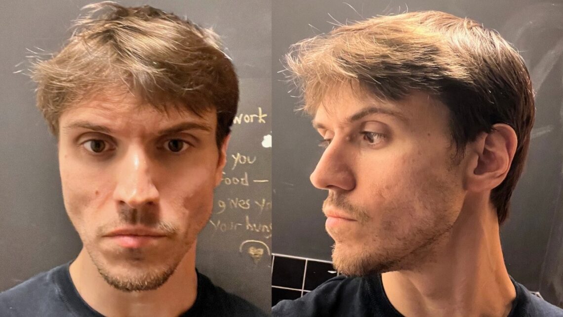 5 Things That Made My Face Lean